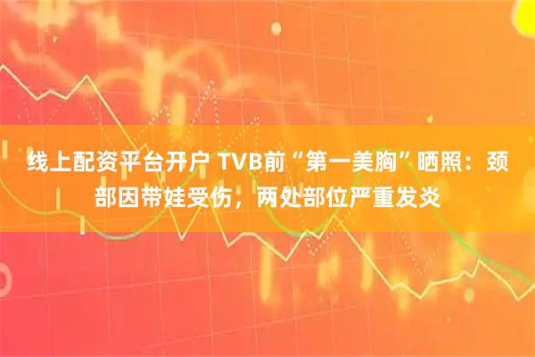 线上配资平台开户 TVB前“第一美胸”晒照：颈部因带娃受伤，两处部位严重发炎